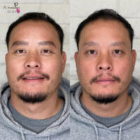 Daniel Microblading Before After Kayana Beauty Claremont