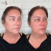 Jolean Microblading Before After Kayana Beauty Claremont