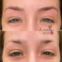 Kelli Microblading Before After Kayana Beauty