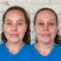 Leah Microblading Before After Kayana Beauty Claremont
