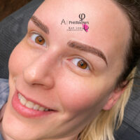 Lindsay Microblading Before-1