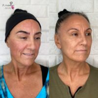 Terry Microblading Before After Kayana Beauty Claremont