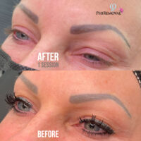 Jill Eyebrow Removal Kayana Beauty One Session