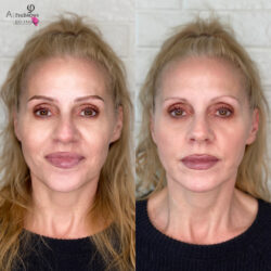 Laura Microblading Before After Kayana Beauty Claremont Laura Microblading Before After Kayana Beauty Claremont