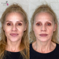 Laura Microblading Before After Kayana Beauty Claremont