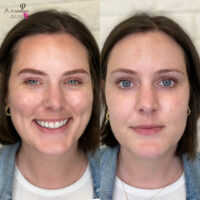 Tara Microblading Before After Kayana Beauty Claremont